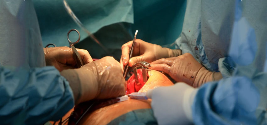 Minimally Invasive Cardiac Surgery (MICS)